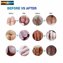 Load image into Gallery viewer, Ariella Nail Fungus Treatment for Toenail and Fingernail, Maximum Strength Antif
