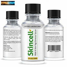 Load image into Gallery viewer, (2 Pack) Skincell Mole and Skin Tag Remover Fast Acting Skin Cell Corrector Remo
