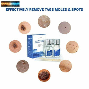 Amada Pure Mole Corrector & Skin Tag Remover and Repair Lotion Set, Remove Moles