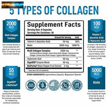 이미지를 갤러리 뷰어에 로드 , Premium Multi Colágeno Péptidos (Tipos I,II,III, V, X) -collagen Píldoras para
