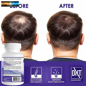 Propidren by HairGenics - DHT Blocker with Saw Palmetto To Prevent Hair Loss and