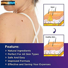 Load image into Gallery viewer, NOVOME Skin Tag Remover &amp; Wart Remover - Quickly and Easily Remove Common Skin T
