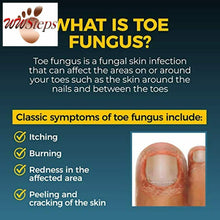 Load image into Gallery viewer, Fungi-Nail, Anti-Fungal Solution, 1 Ounce
